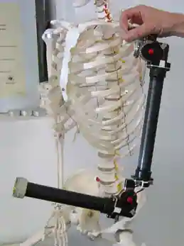 Edinburgh Modular Arm System